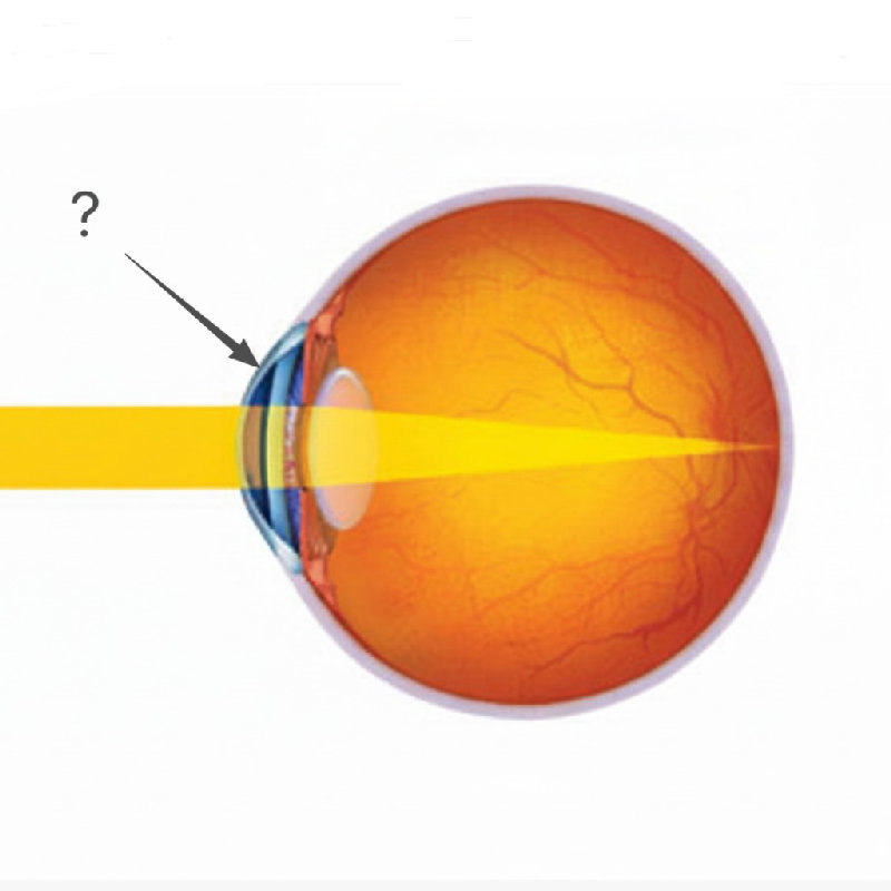 光线在进入晶状体之前先穿过角膜。
