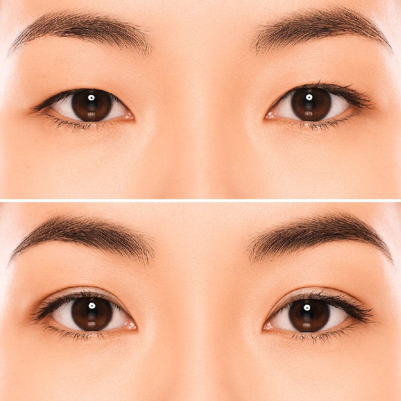 我想她做过双眼皮手术。