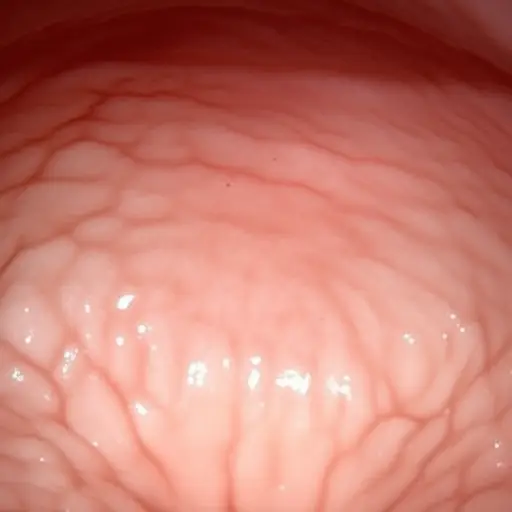 我早餐前胃会咕咕叫。