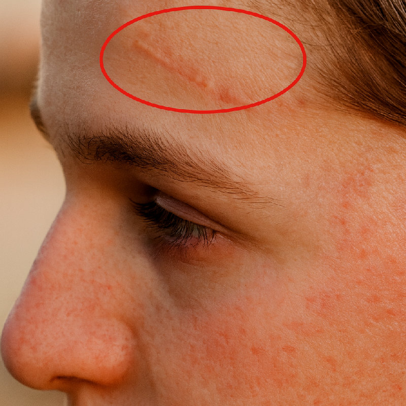 他额头上有一道疤。