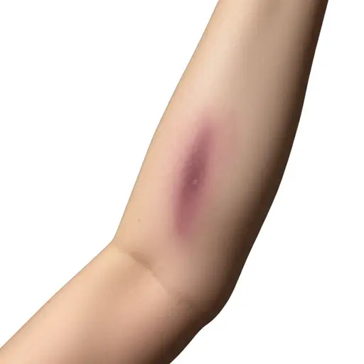 我确信我的手肘上会有一块漂亮的淤青。