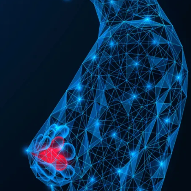 她母亲死于乳腺癌。