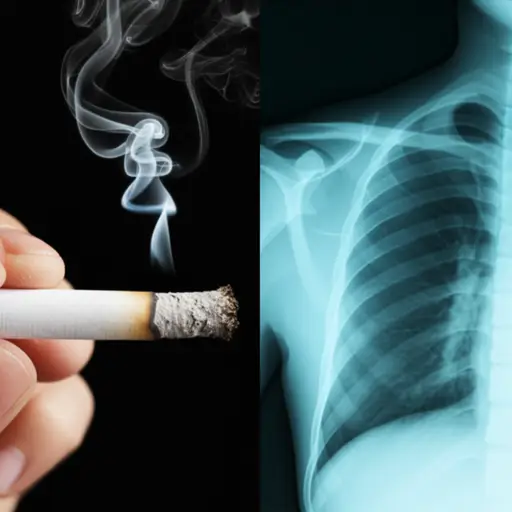 吸烟会严重损害你的健康。