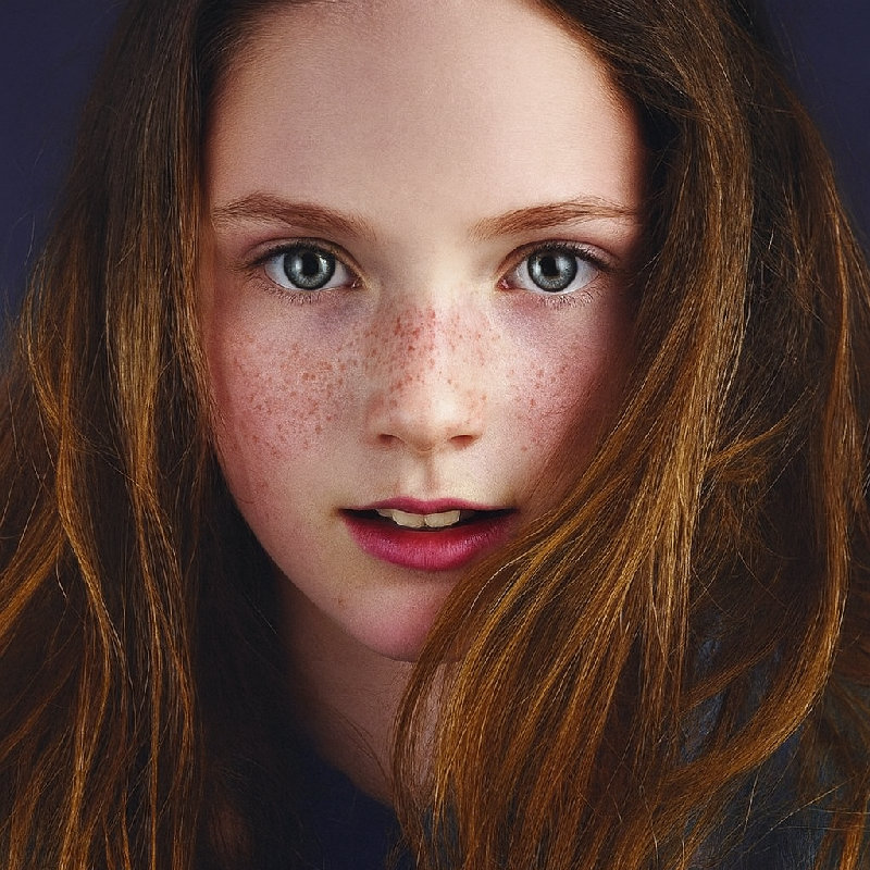 她的雀斑给她带来了独特而迷人的外观。