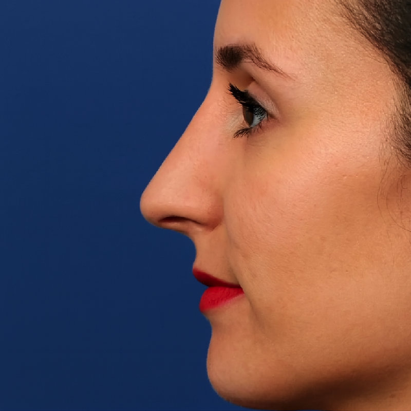 她有一个尖尖的鼻子，让她的脸看起来很有特色。