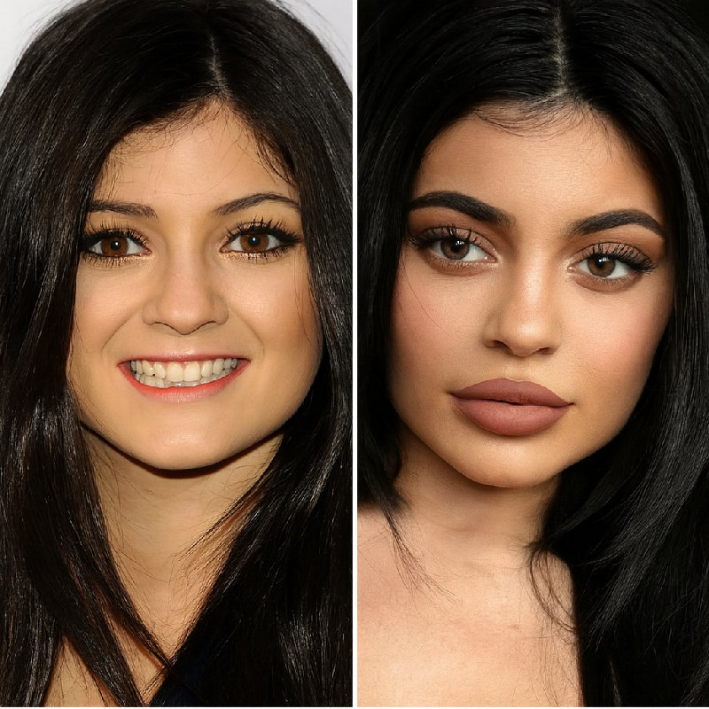 薄嘴唇和厚嘴唇