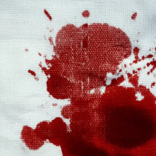 绷带上沾满了血。